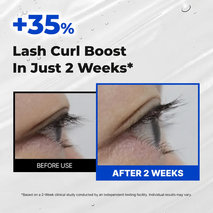 ✨  Essential Eyelash Growth Serum – Jumbo 0.5 fl oz | Fuller, Thicker & Longer-Looking Lashes in 2 Weeks | Gentle, Hormone-Free & Prostaglandin-Free 💙