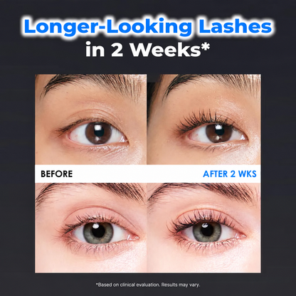 ✨  Essential Eyelash Growth Serum – Jumbo 0.5 fl oz | Fuller, Thicker & Longer-Looking Lashes in 2 Weeks | Gentle, Hormone-Free & Prostaglandin-Free 💙